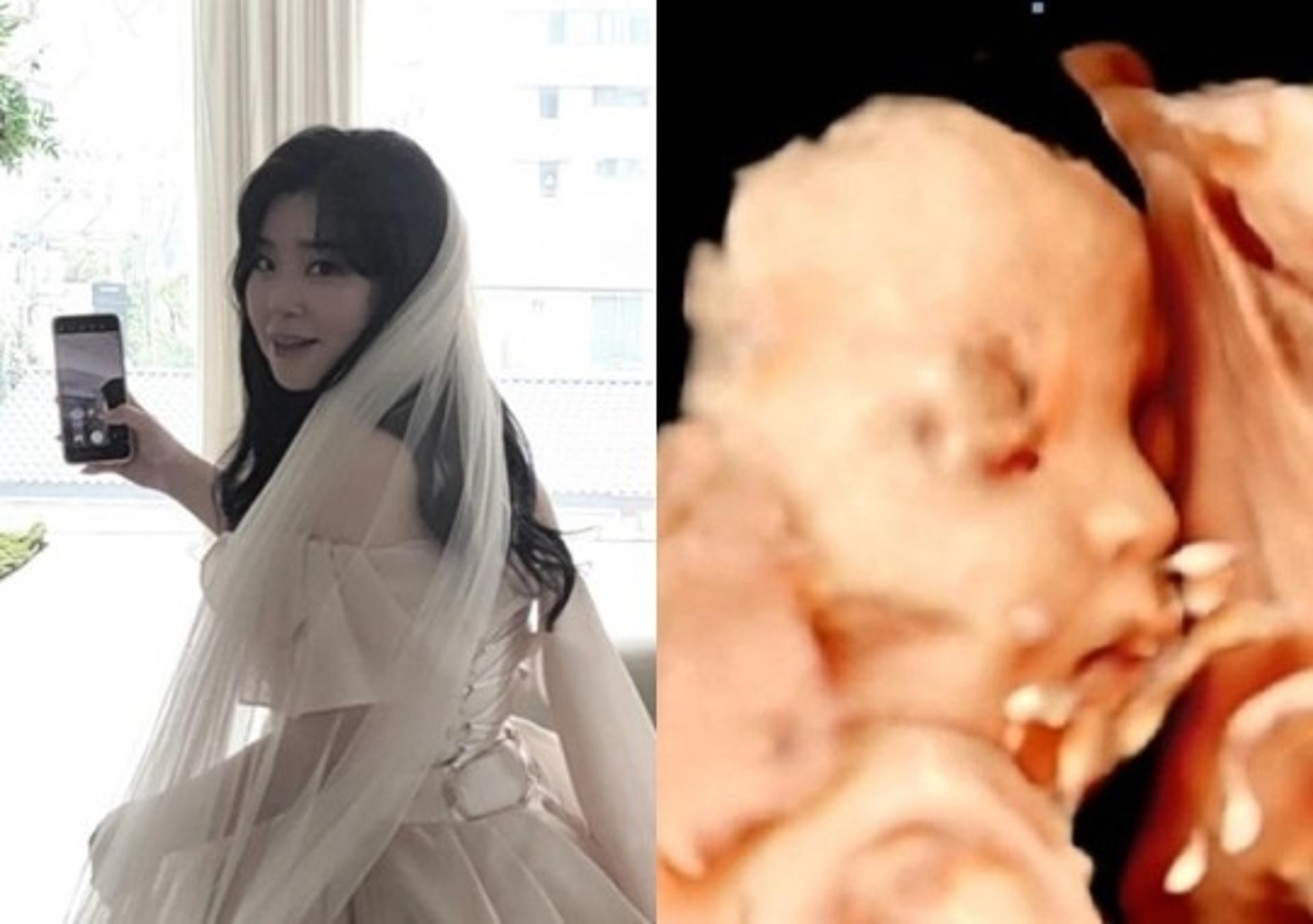 '킹콩을 들다' 전보미 엄마된다… "결혼하자마자 임신"