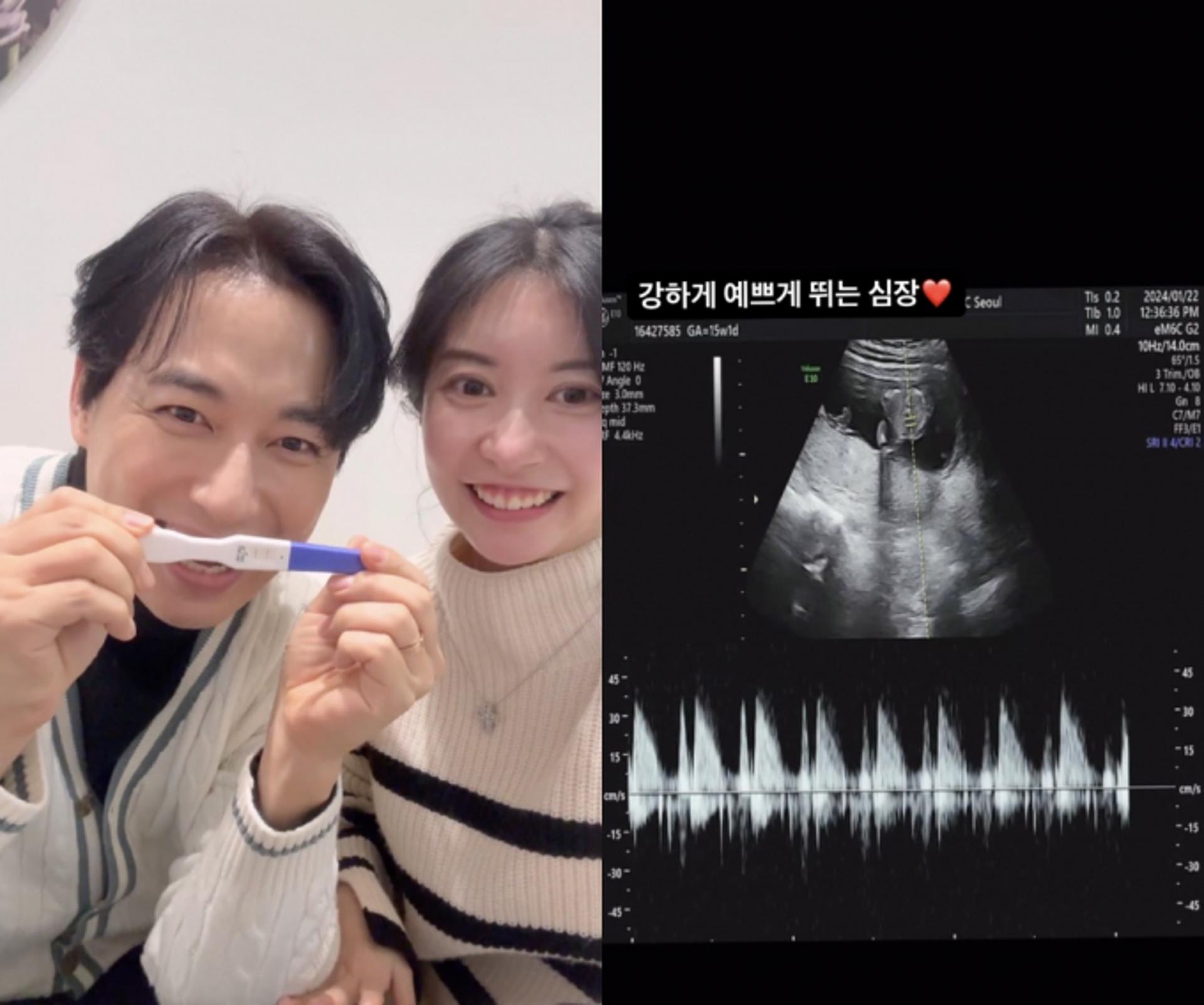 이지훈♥아야네 임신… "벌써 19주 된 우리 아가"