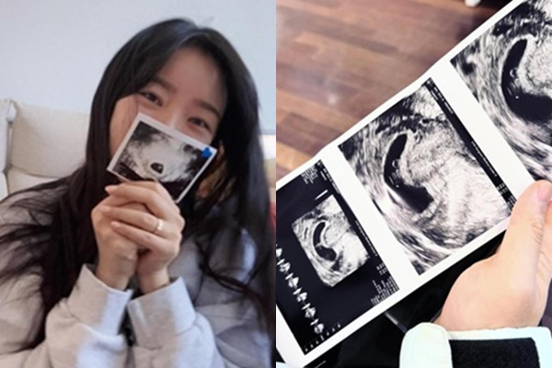 '임신' 배슬기 엄마된다… "그토록 원하던 아기 천사"