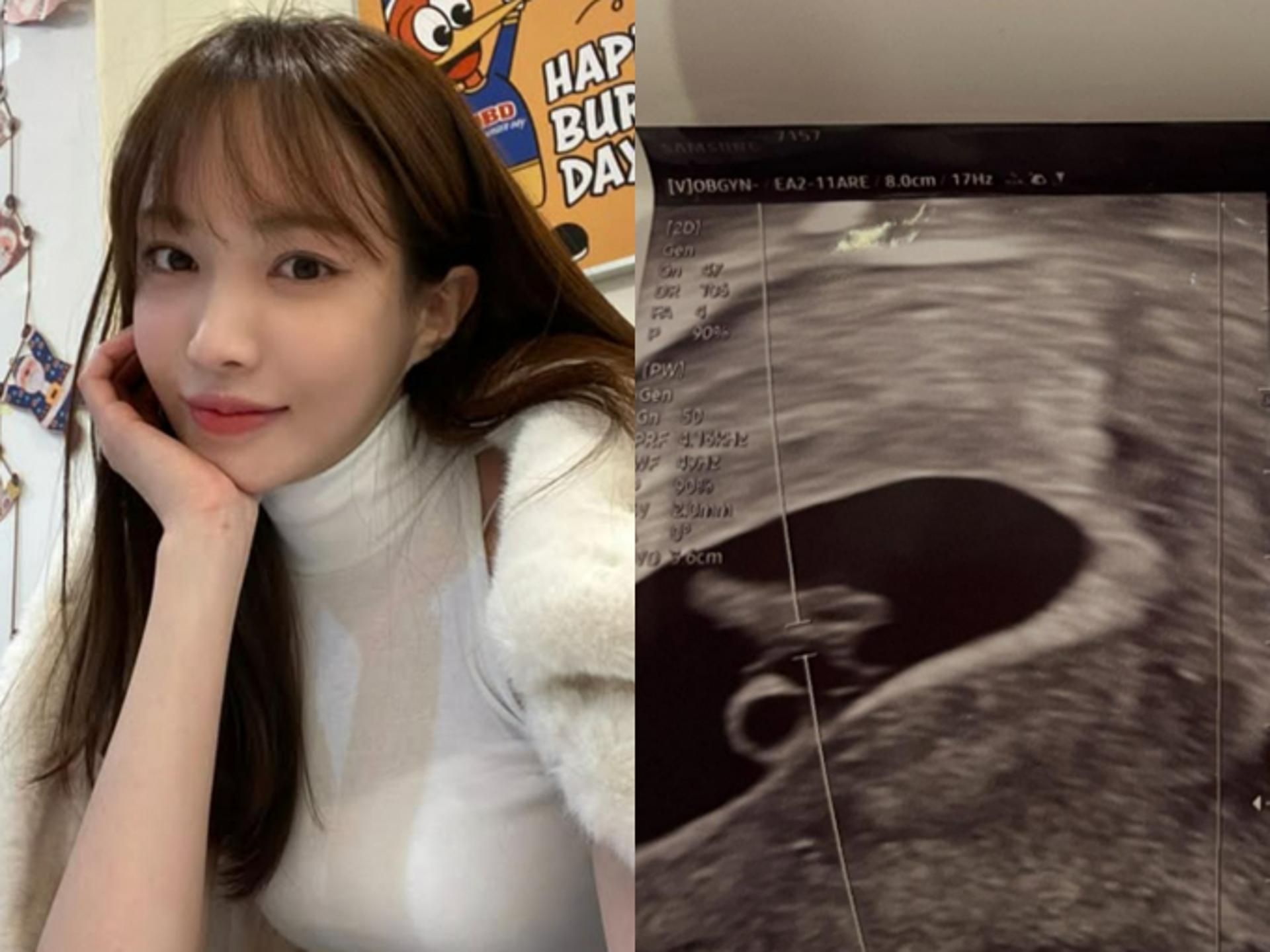 임신 사실 알린 서은우 "남친은 스토킹 고소하겠답니다"