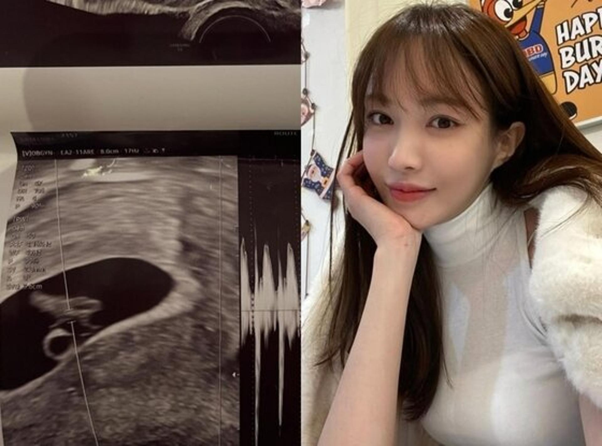 '임신' 서민재 "아기 친부 여전히 연락 없어, 책임·도리 외면"