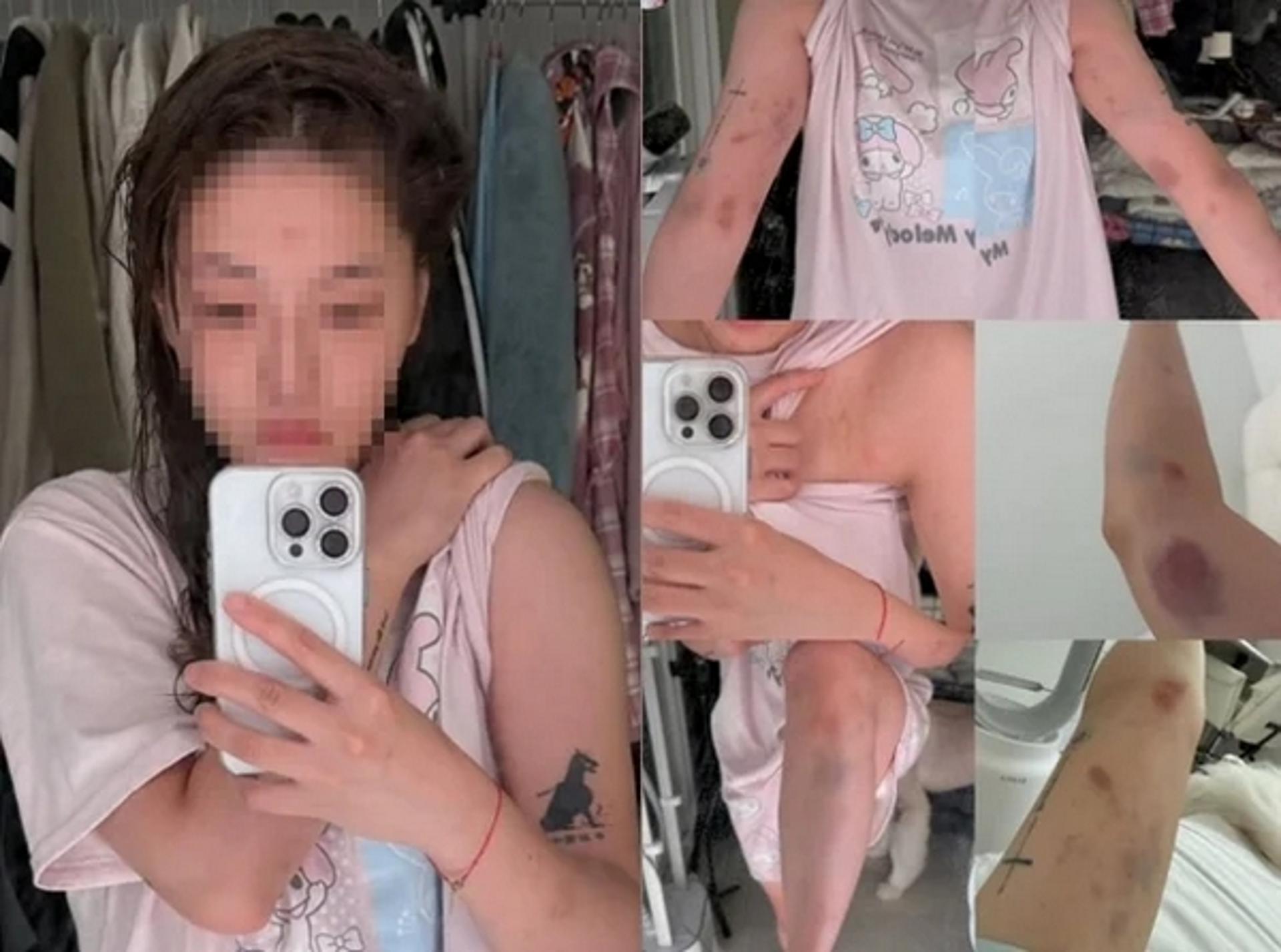 "원나잇 거절했다고"… 여성 유튜버, 홍대 앞서 '무차별 폭행' 당했다