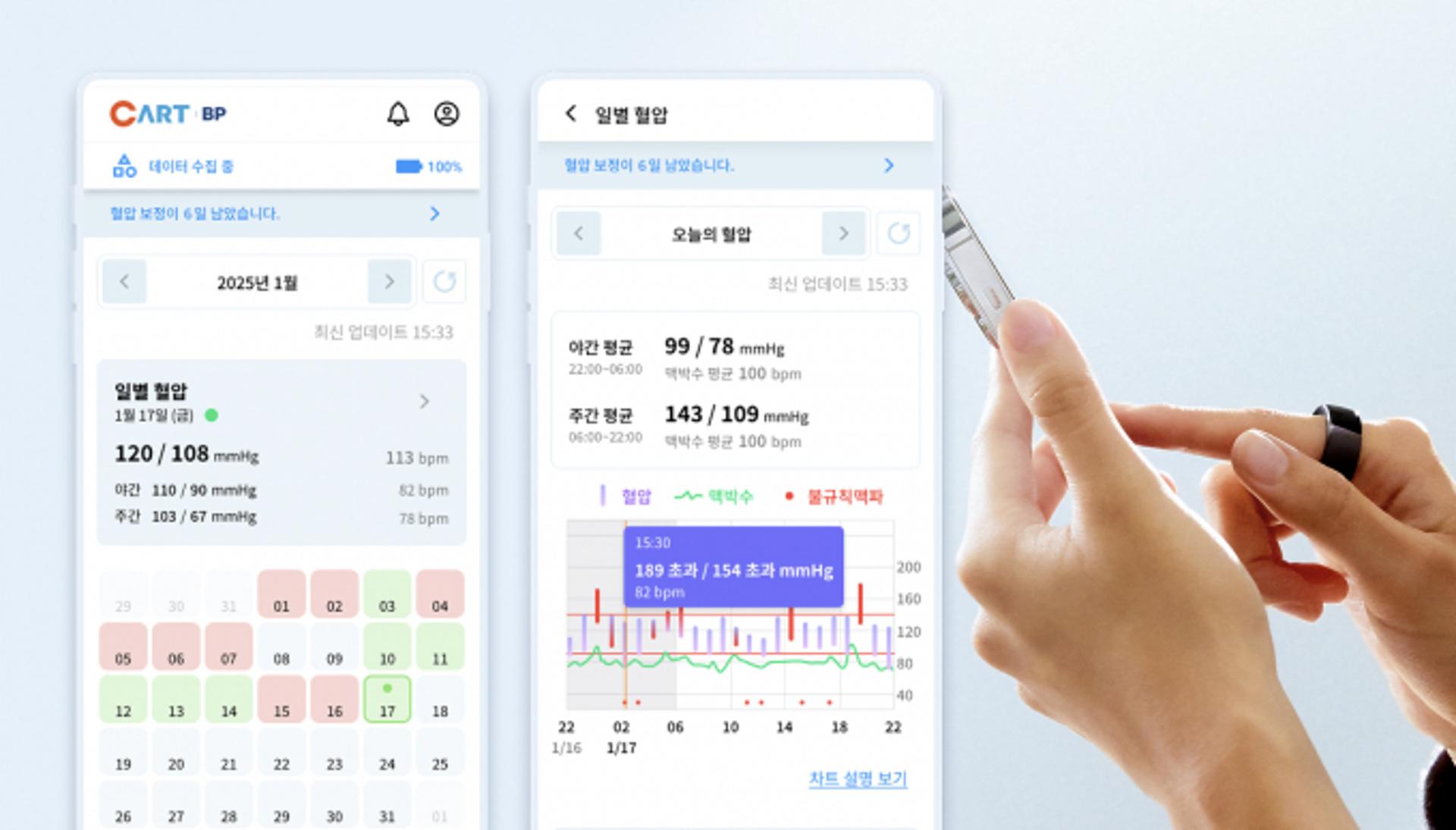 한밤에도 혈압 잰다… 스카이랩스, 반지형 '카트 비피' 출시
