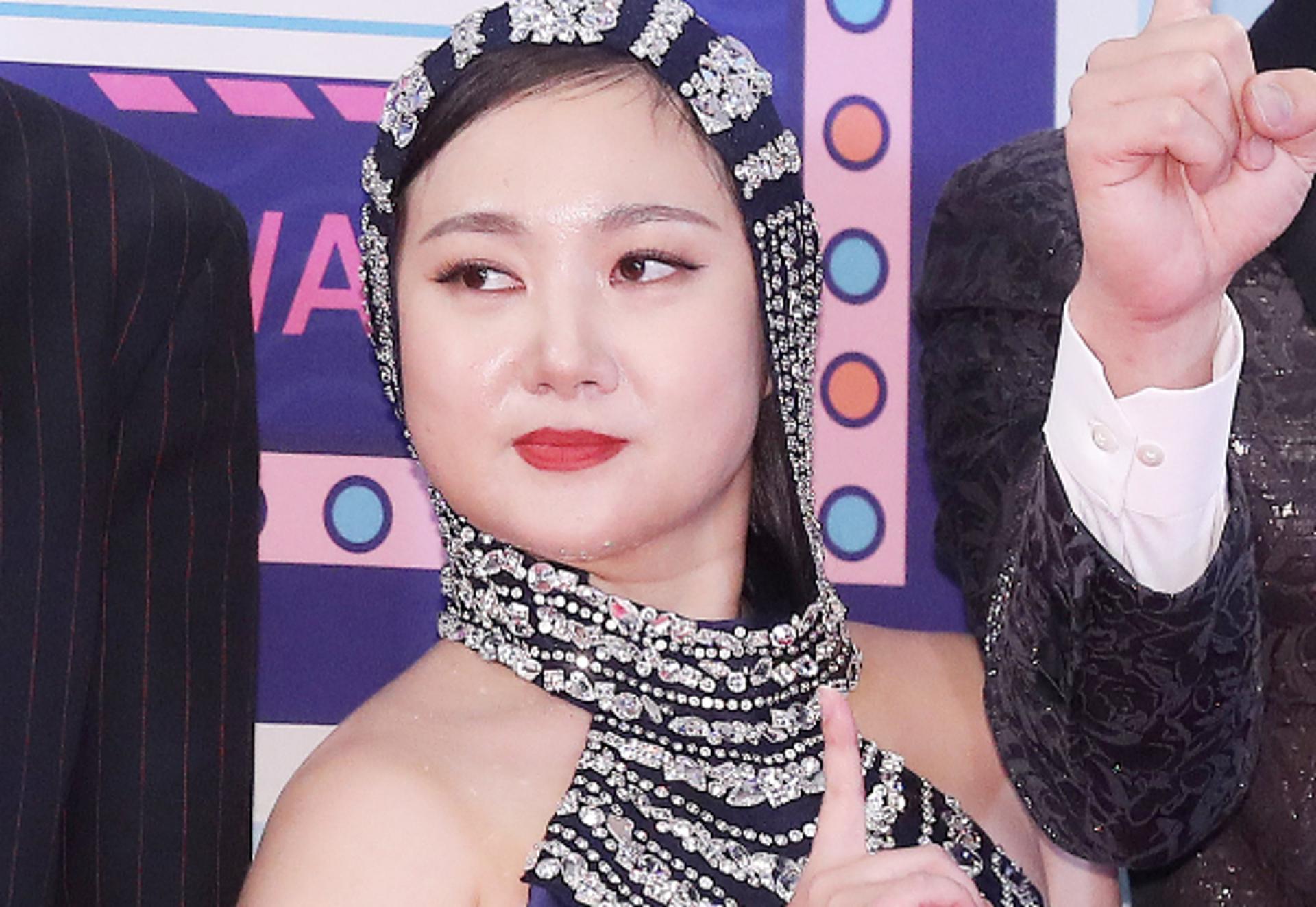 '갑질·횡령 논란' 박나래, 이번엔 무면허 '주사 이모' 불법 의료 시술 의혹