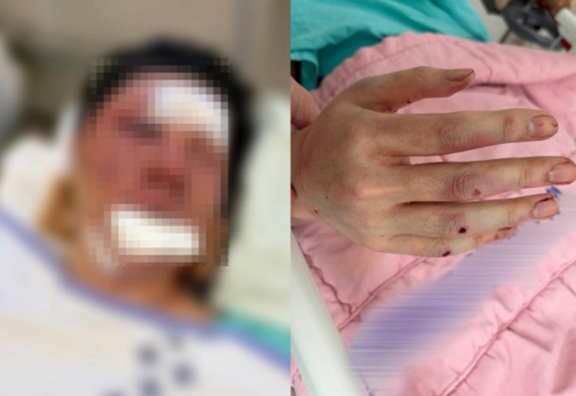 "1분1초 아까운 인생"… 야구배트로 폭행, 유튜버 수탉 복귀 예고
