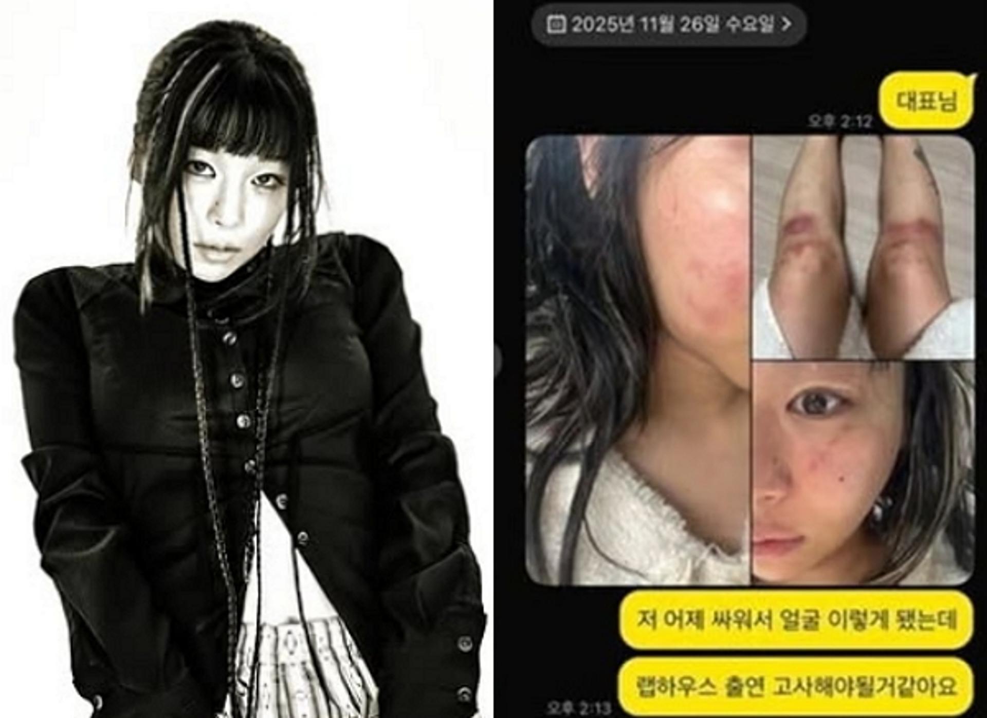 '데이트폭행 폭로' 재키와이, 한달만에 입장 번복… "흉기위협 사실아냐"