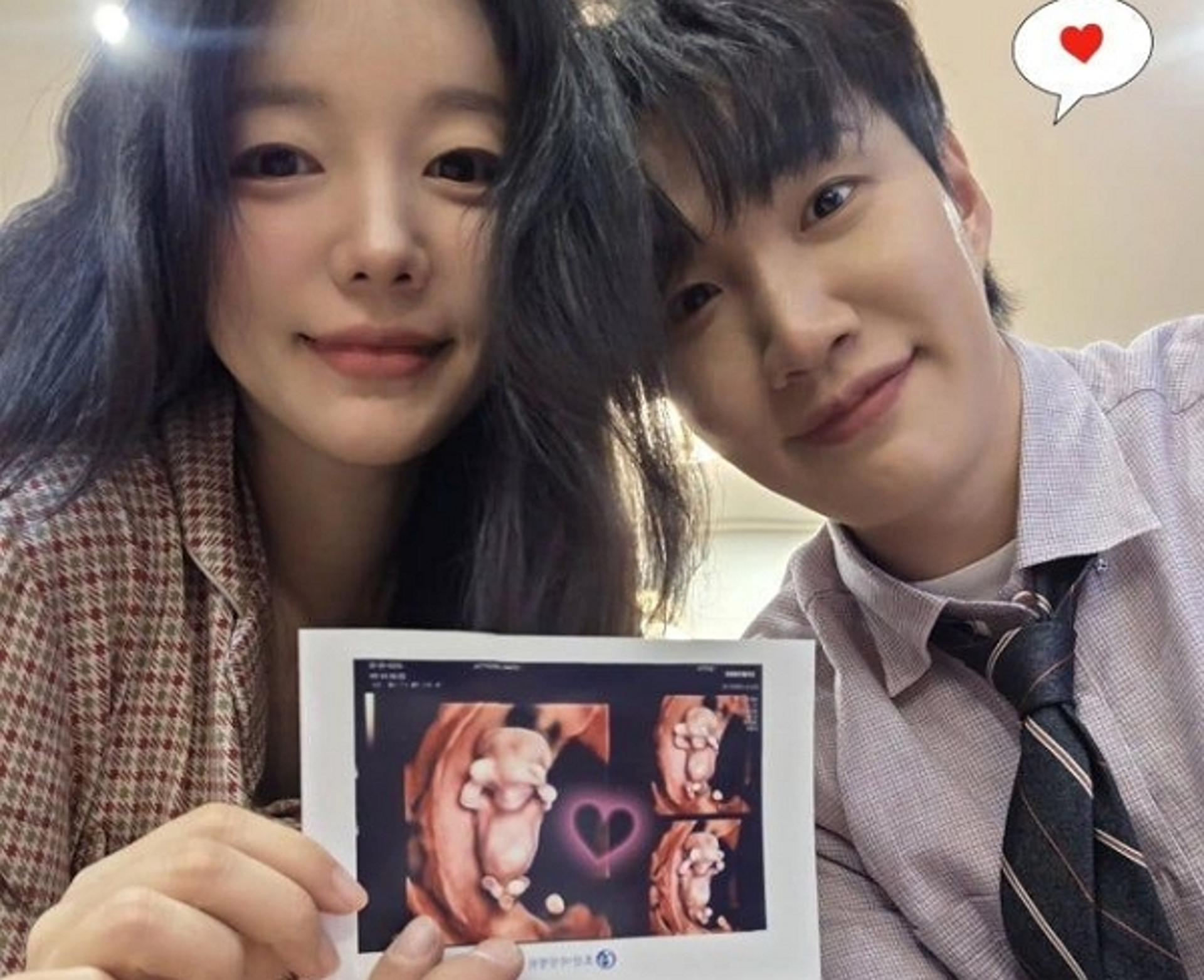 문지인♥김기리, 유산 딛고 시험관 성공…"8월에 만나게 될 생명"