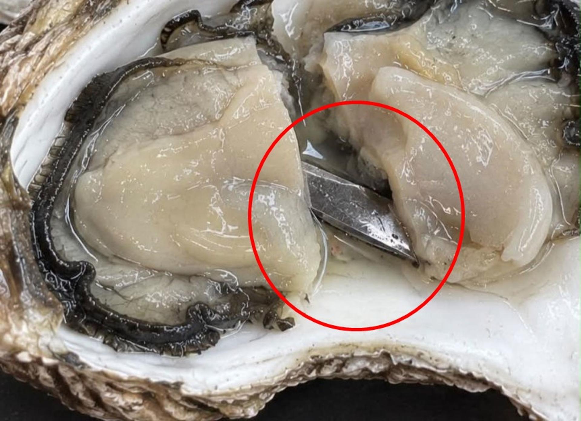 "굴에서 5㎝ 칼날 나와" 삼켰다면 '아찔'…내놓은 건 새 굴 2개