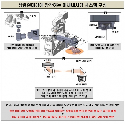 상용현미경에 장착하는 미세내시경 시스템 구성 모식도. /출처=서울아산병원