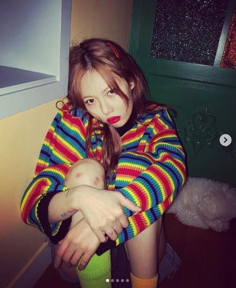 현아, 무릎에 멍… 격렬한 연습 때문?