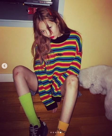 현아, 무릎에 멍… 격렬한 연습 때문?