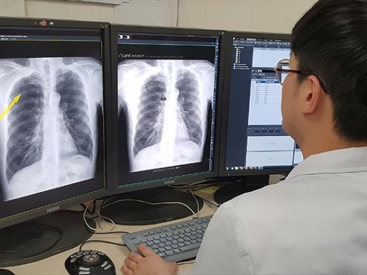서울대병원이 도입한 인공지능(AI) 기술 '루닛 인사이트'. /사진=서울대병원