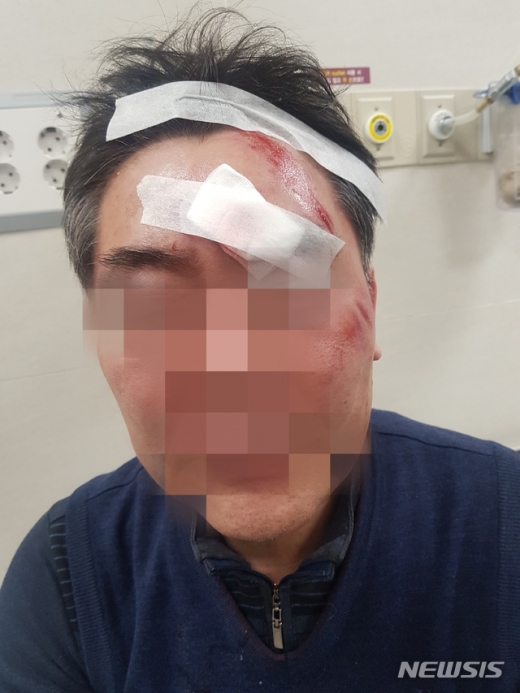지난 22일 최재성 강북구의원에게 폭행당한 동장 조모씨(59). /사진=뉴시스(피해자 제공)