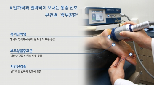 [건강] 지간신경증에서 족저근막염까지… 발에 찾아온 통증