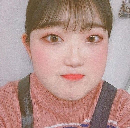 루푸스병 최준희 근황. /사진=최준희 SNS