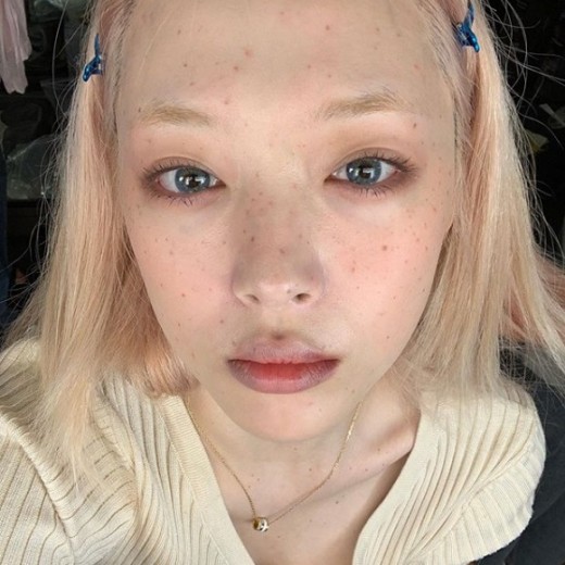 설리 주근깨./사진=설리 인스타그램