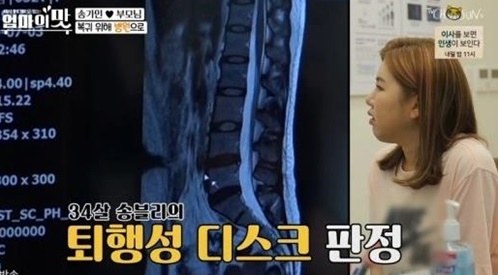 송가인 퇴행성디스크./사진=아내의 맛 방송캡처