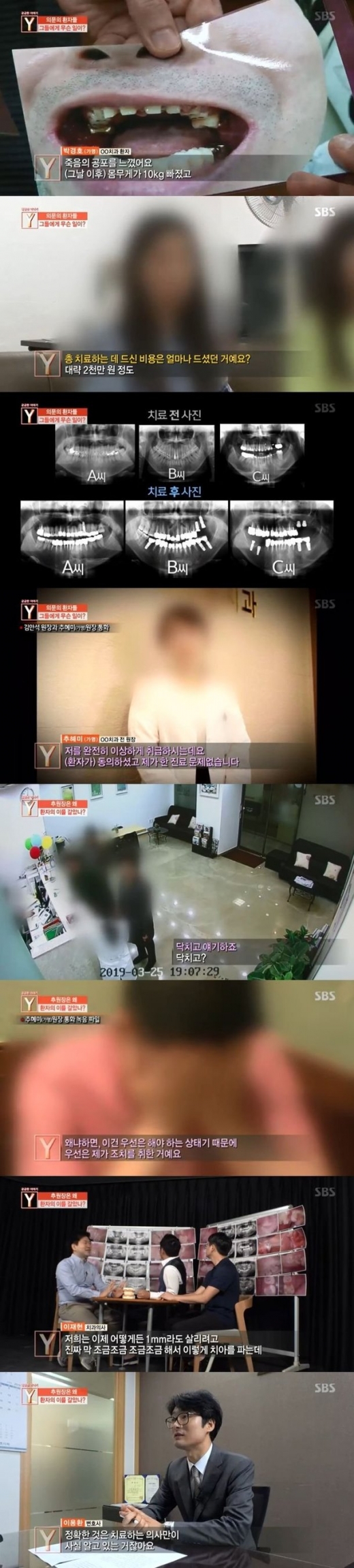 궁금한이야기y 치과./사진=SBS 방송캡처