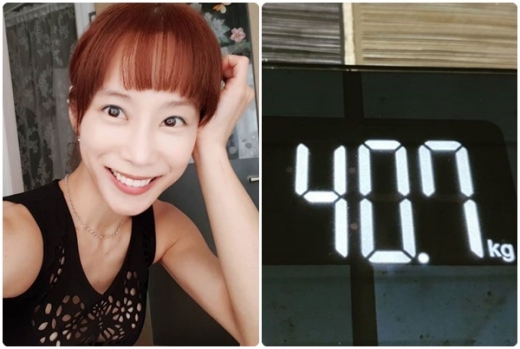 조민아 레이노병. /사진=조민아 인스타그램