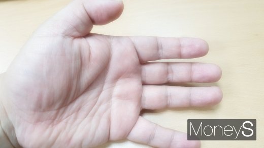 [건강] 손 저림 증상, 목디스크·후종인대 골화증… 터널증후군과 구별하는 방법?