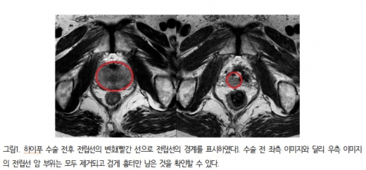 ./사진=분당서울대병원