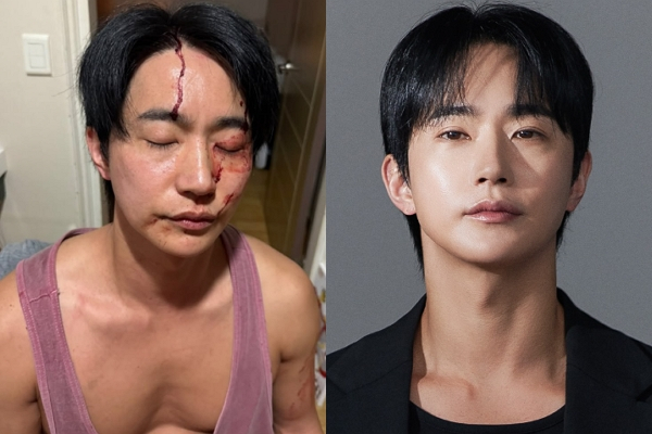 "폭행하고 성병 옮겨·접대까지"… 유명 뮤지컬 배우, 무슨 일?